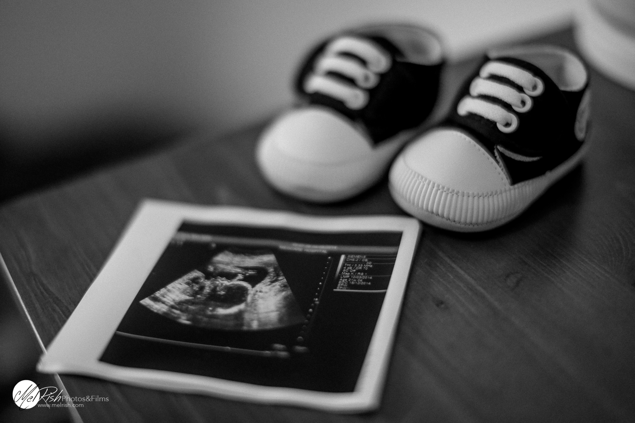 A Maternity Shoot | Simple Motherhood in Black and White - The MelRish ...